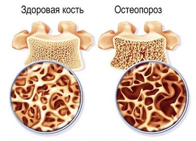 фосфат фосфат