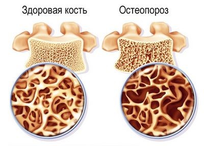 фосфат