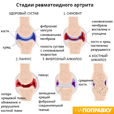 специальный специальный