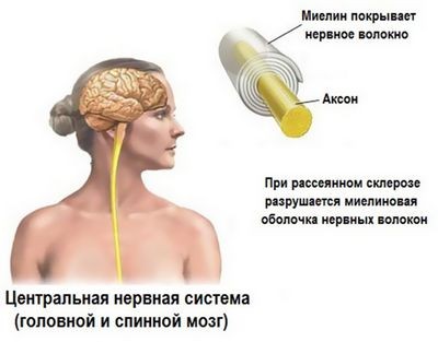 пациент пациент