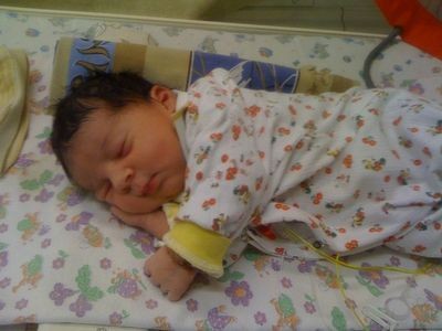 кардиостимулятор