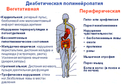 диабетической невропатии