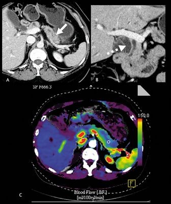 расположение