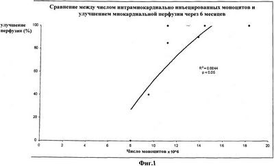 хантингтона