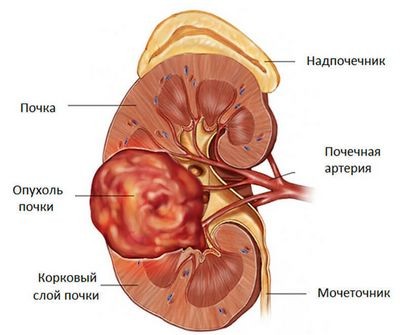 воспаление