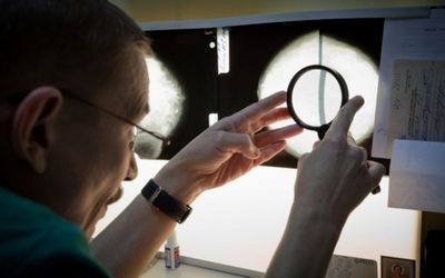 остеоартрита